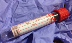 NatMed: основной причиной смерти от рака могут быть не метастазы