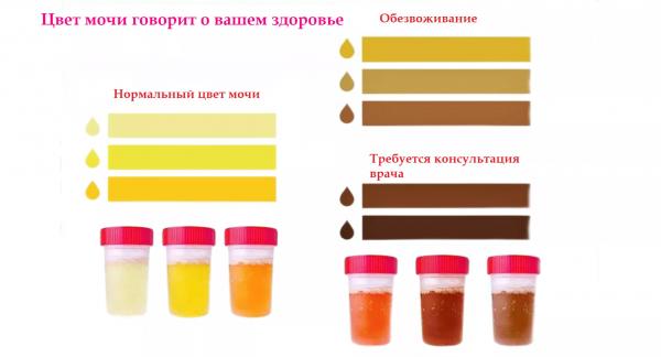 О чем может говорить цвет мочи: понятная памятка (фото)